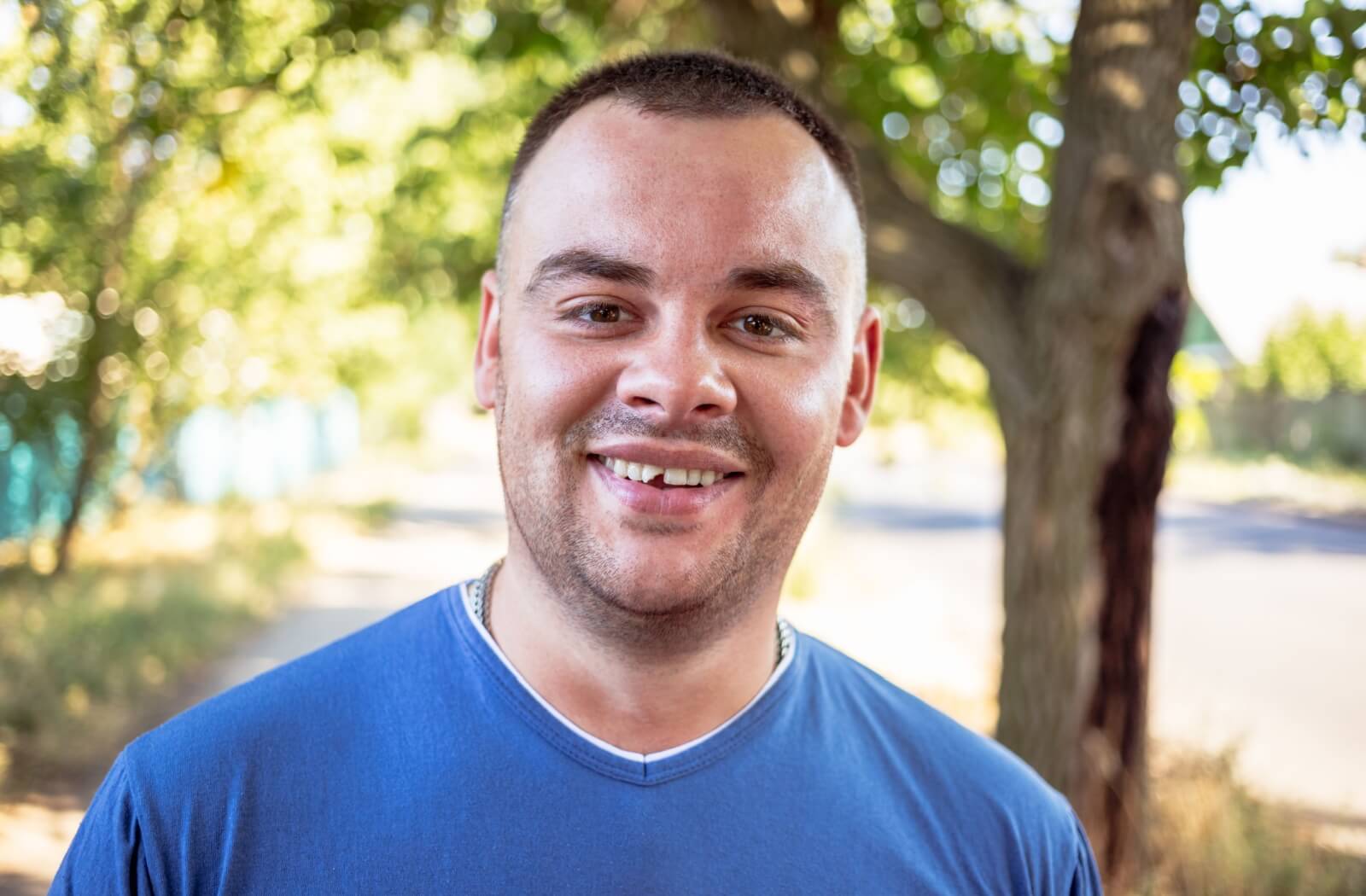 A picture of a person wearing a blue t-shirt, and smiling with their chipped front tooth.