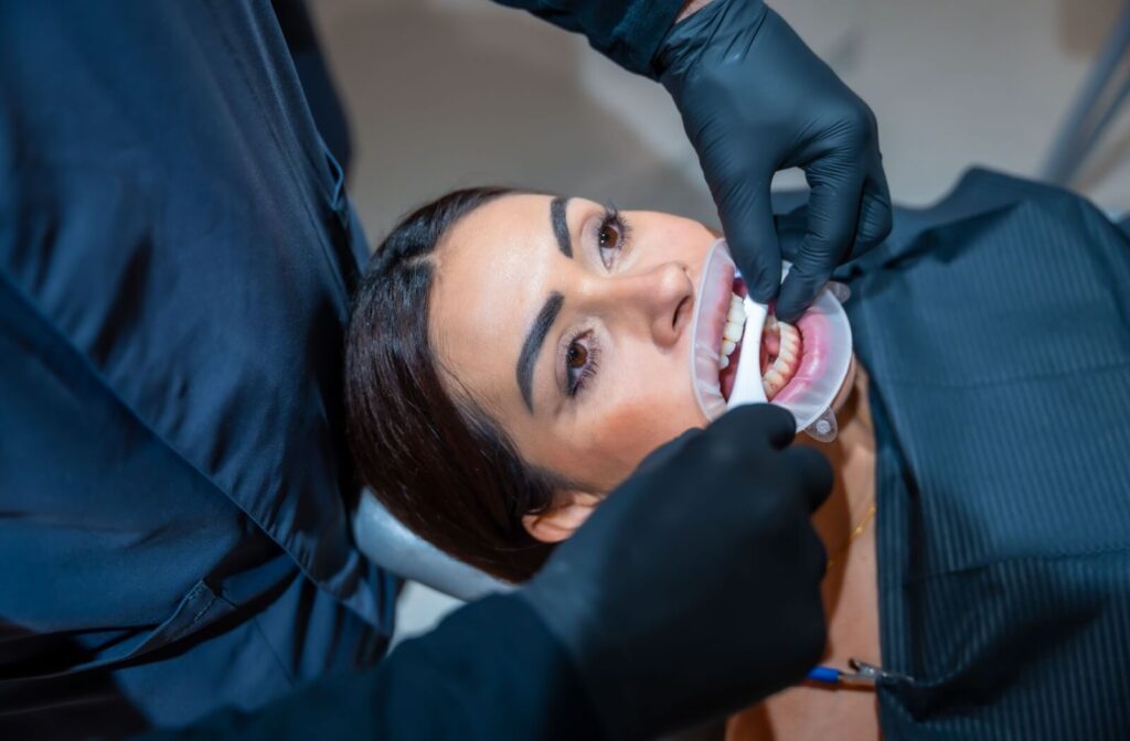 Dental professional in black gloves examining patient’s teeth using a plastic cheek retractor during oral exam